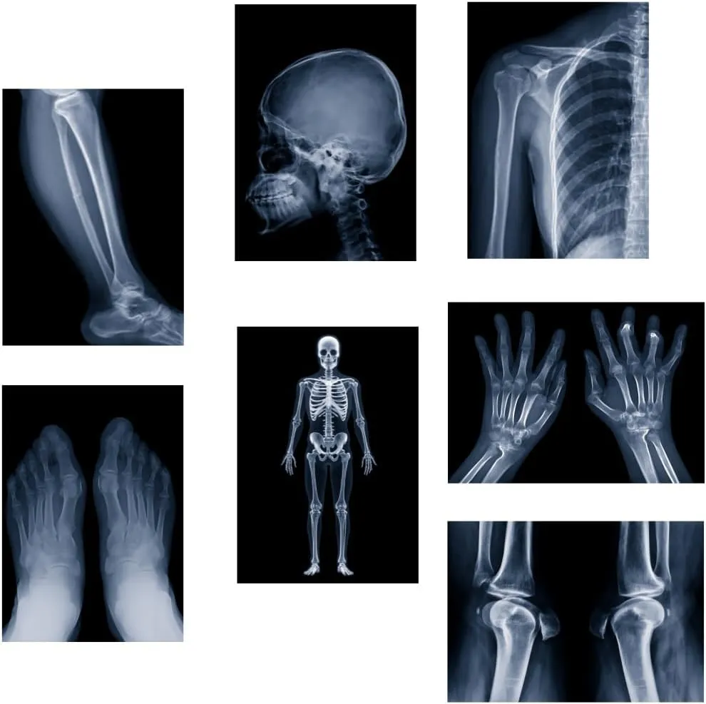 X-ray Science Education Package for Human Anatomy and Bone Parts is Suitable for Light Table and lamp Fittings.